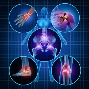 arthrosis artritisz kezelési rendszerek